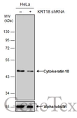 Anti-Cytokeratin 18 antibody [N2C2], Internal used in Western Blot (WB). GTX105624
