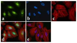 Anti-CREB (phospho Ser129/Ser133) antibody used in Immunocytochemistry/ Immunofluorescence (ICC/IF). GTX10564