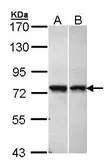 Anti-C11orf2 antibody [C1C3] used in Western Blot (WB). GTX105644