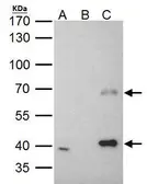 Anti-MSL3L1 antibody used in Immunoprecipitation (IP). GTX105652