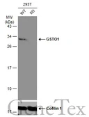 Anti-GSTO1 antibody [N1C3] used in Western Blot (WB). GTX105655