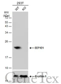 Anti-EEF1E1 antibody [N1C3] used in Western Blot (WB). GTX105658