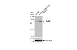 Anti-Bcl-X antibody used in Western Blot (WB). GTX105661