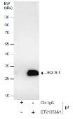 Anti-Bcl-X antibody used in Immunoprecipitation (IP). GTX105661