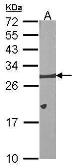 Anti-Bcl-X antibody used in Western Blot (WB). GTX105661