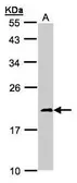 Anti-NDUFS4 antibody used in Western Blot (WB). GTX105662