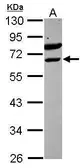 Anti-TEL antibody [N1N3] used in Western Blot (WB). GTX105673