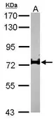 Anti-IL17 Receptor D antibody [N3C2], Internal used in Western Blot (WB). GTX105688