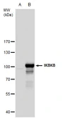 Anti-IKK beta antibody used in Western Blot (WB). GTX105690