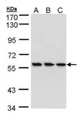 Anti-HCE antibody [N1N3] used in Western Blot (WB). GTX105694