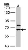 Anti-LGI1 antibody [N2C2], Internal used in Western Blot (WB). GTX105700