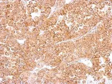 Anti-DR3 antibody used in IHC (Paraffin sections) (IHC-P). GTX105713