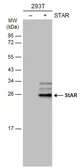 Anti-StAR antibody used in Western Blot (WB). GTX105716
