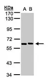 Anti-NT5C2 antibody [N2C1], Internal used in Western Blot (WB). GTX105719
