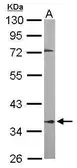 Anti-PPP2R4 antibody [N2C3] used in Western Blot (WB). GTX105724