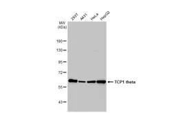Anti-TCP1 theta antibody [N2C2], Internal used in Western Blot (WB). GTX105725