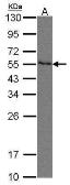 Anti-Nectin 2 antibody used in Western Blot (WB). GTX105742