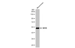 Anti-NFIB antibody [N1C2] used in Western Blot (WB). GTX105749