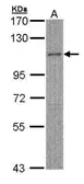 Anti-MYBPC2 antibody [N3C1], Internal used in Western Blot (WB). GTX105777