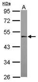Anti-PRAK antibody [N1C1] used in Western Blot (WB). GTX105778