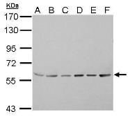Anti-ASC1 antibody used in Western Blot (WB). GTX105780