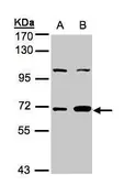 Anti-GBP1 antibody [N2C2], Internal used in Western Blot (WB). GTX105782