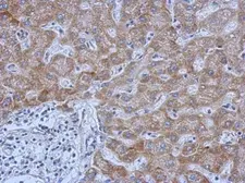 Anti-IL13 Receptor alpha 1 antibody used in IHC (Paraffin sections) (IHC-P). GTX105788
