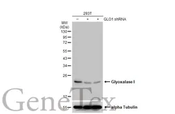Anti-Glyoxalase I antibody [N1C3] used in Western Blot (WB). GTX105792