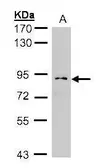 Anti-Glucosidase I antibody [N1N3] used in Western Blot (WB). GTX105798