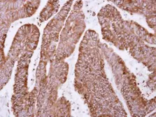 Anti-OSGEP antibody used in IHC (Paraffin sections) (IHC-P). GTX105808