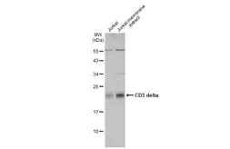 Anti-CD3 delta antibody used in Western Blot (WB). GTX105811