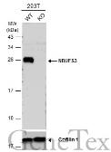 Anti-NDUFS3 antibody used in Western Blot (WB). GTX105835