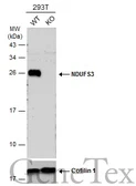 Anti-NDUFS3 antibody used in Western Blot (WB). GTX105835