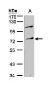 Anti-ZNF42 antibody [N2C1], Internal used in Western Blot (WB). GTX105837