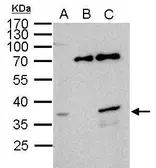 Anti-WBSCR22 antibody used in Immunoprecipitation (IP). GTX105840