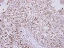 Anti-Protein C antibody used in IHC (Paraffin sections) (IHC-P). GTX105844
