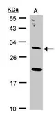 Anti-UROS antibody [N1C3] used in Western Blot (WB). GTX105866