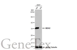 Anti-MDH2 antibody used in Western Blot (WB). GTX105870