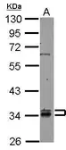 Anti-RABGGTB antibody used in Western Blot (WB). GTX105874