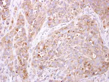 Anti-ETNK1 antibody [N2C3] used in IHC (Paraffin sections) (IHC-P). GTX105887