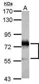 Anti-STAM antibody used in Western Blot (WB). GTX105927