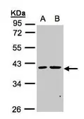 Anti-PSKH2 antibody [N2C3] used in Western Blot (WB). GTX105933