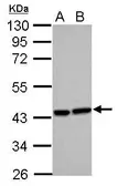 Anti-Heme Oxygenase 2 antibody [N1C3] used in Western Blot (WB). GTX105941