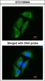 Anti-DPP3 antibody [N2C1], Internal used in Immunocytochemistry/ Immunofluorescence (ICC/IF). GTX105949