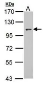 Anti-HEF1 antibody used in Western Blot (WB). GTX105953