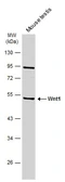 Anti-Wnt1 antibody used in Western Blot (WB). GTX105955