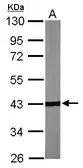 Anti-TBCC antibody [N1C3] used in Western Blot (WB). GTX105962