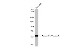 Anti-Monoamine Oxidase B antibody [N2C3] used in Western Blot (WB). GTX105970