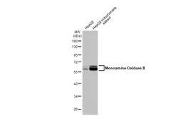 Anti-Monoamine Oxidase B antibody [N2C3] used in Western Blot (WB). GTX105970