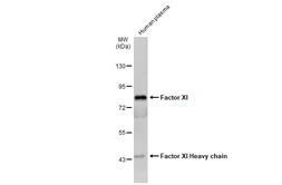 Anti-Factor XI antibody [N1N3] used in Western Blot (WB). GTX105974